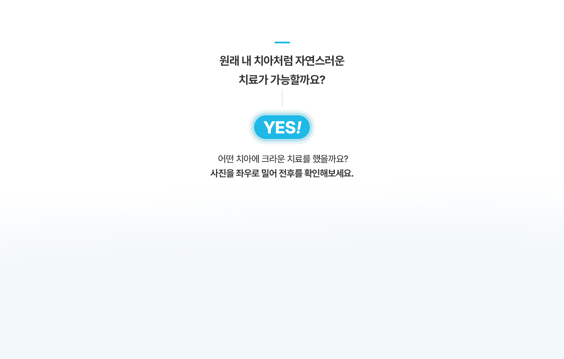올세라믹