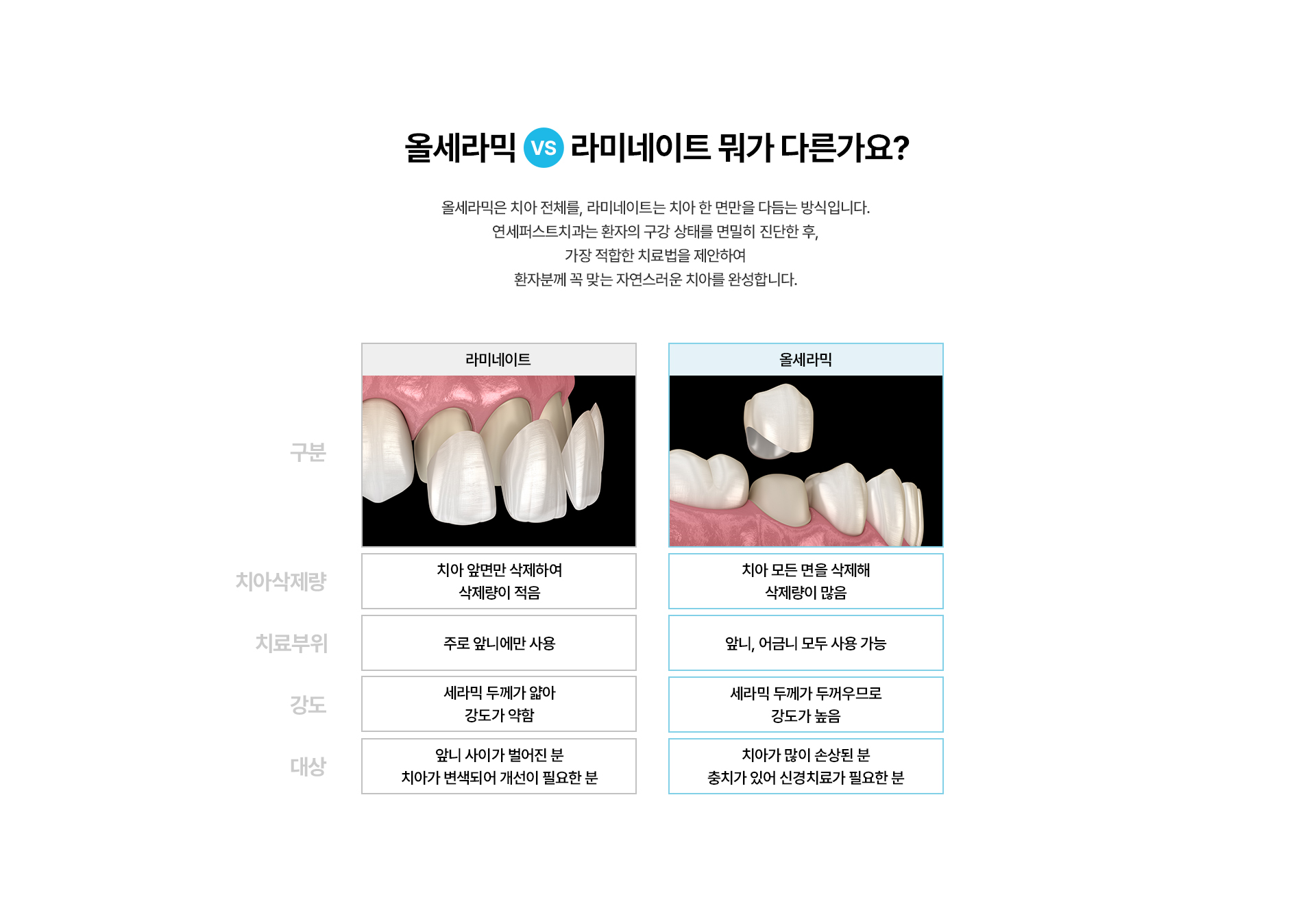 올세라믹