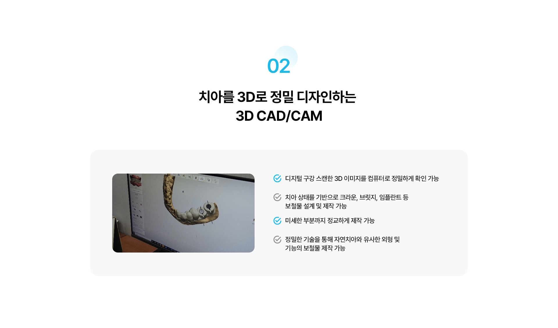 디지털 보철 및 원내 기공실
