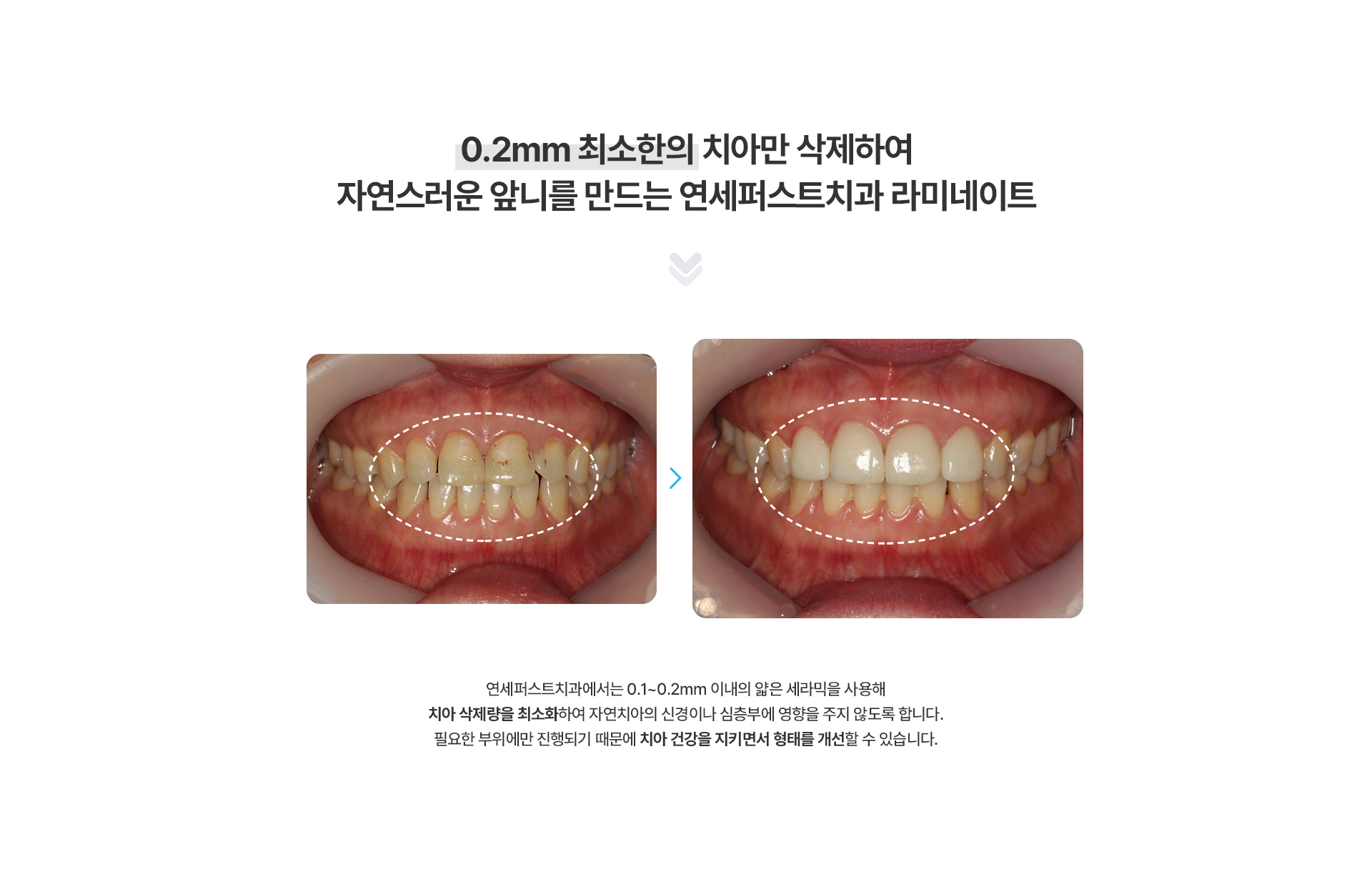 라미네이트