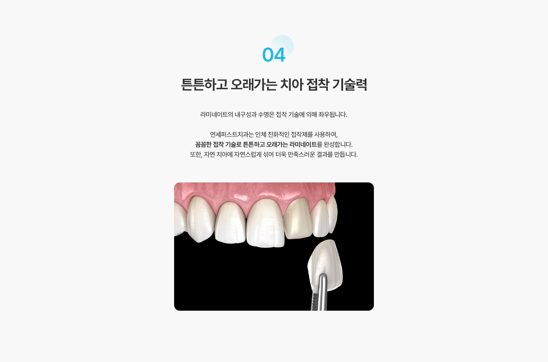 라미네이트