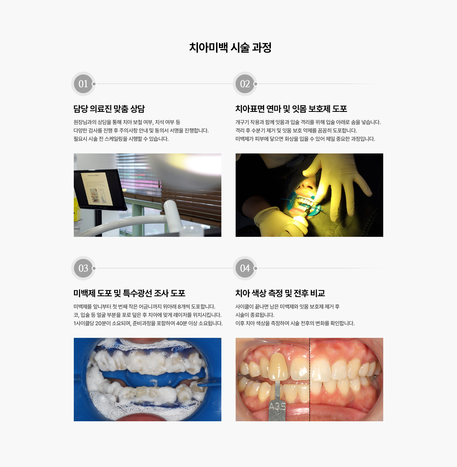 치아미백