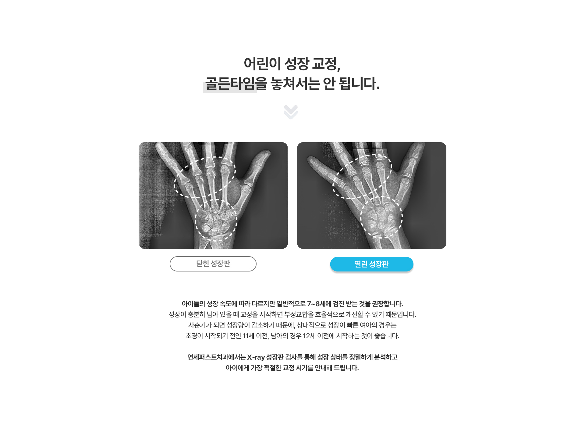 어린이성장교정