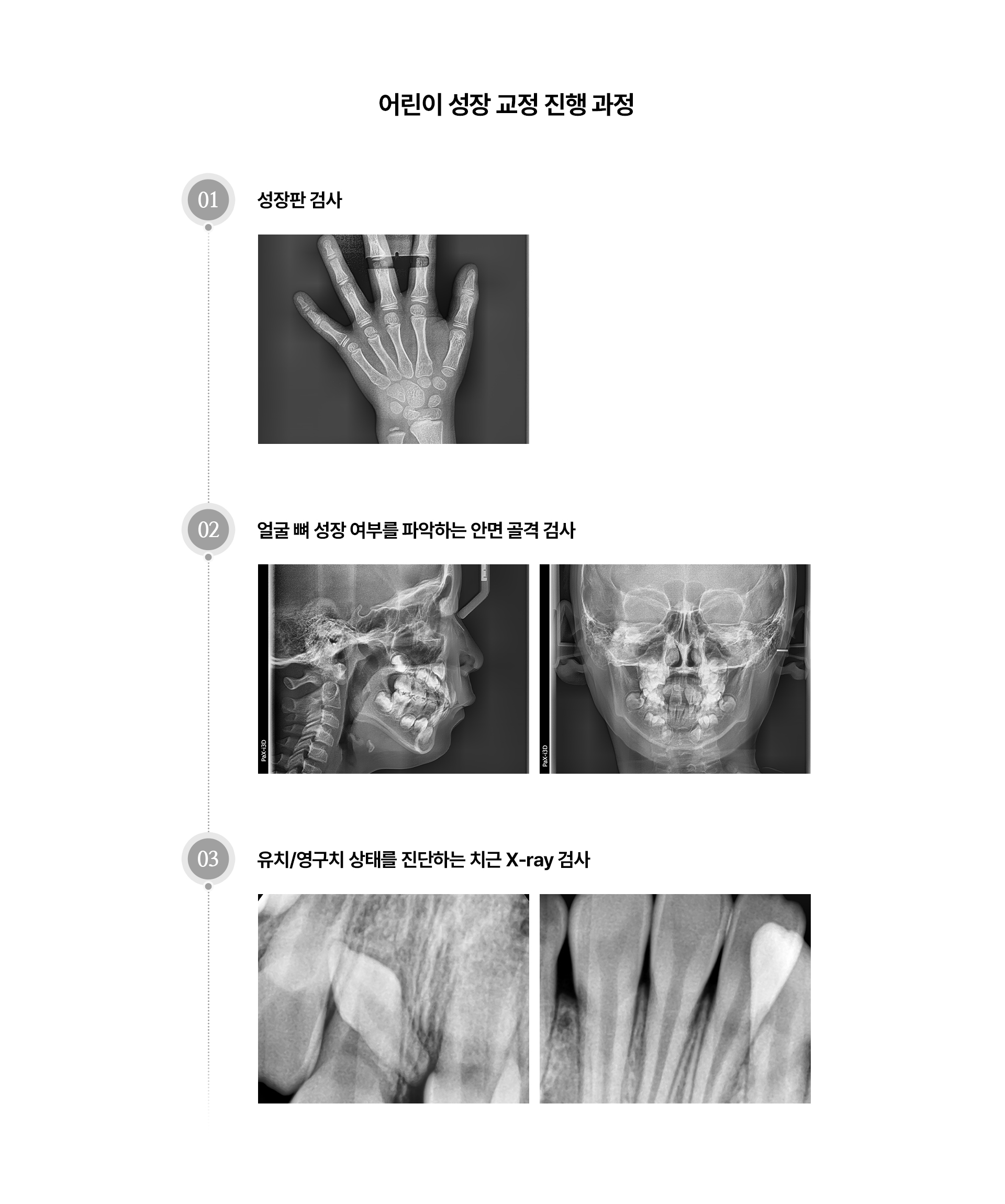 어린이성장교정