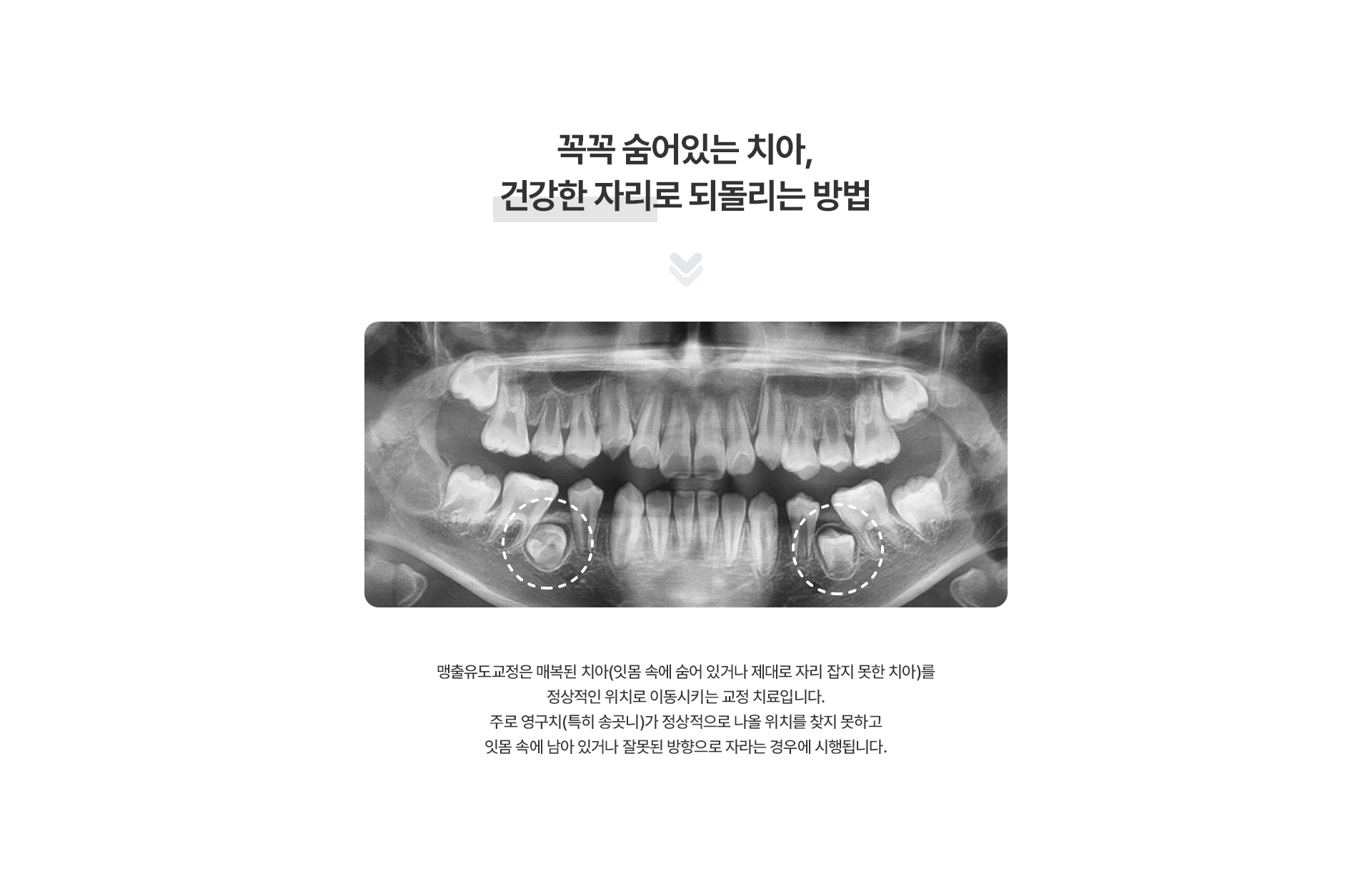 맹출유도교정