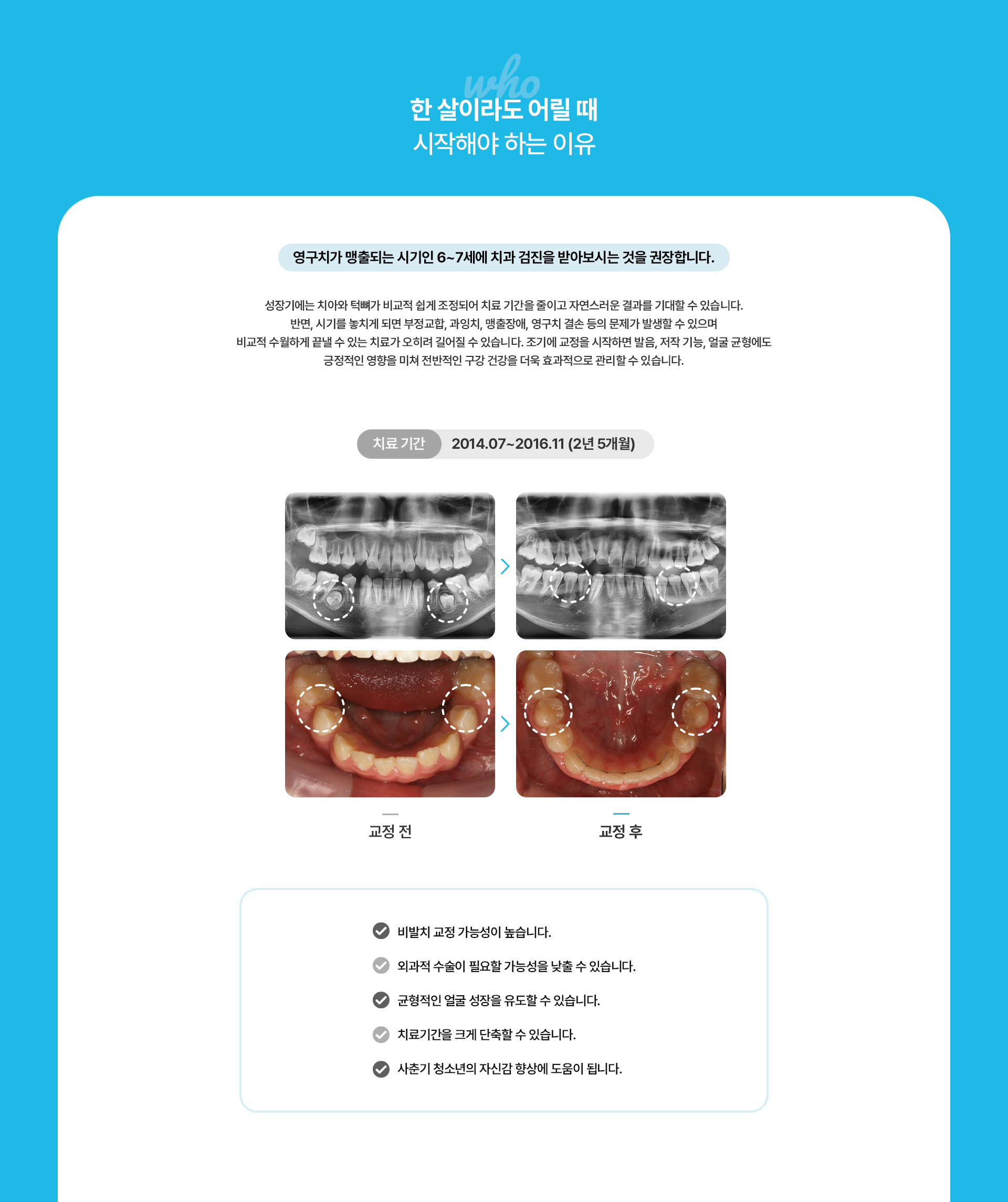맹출유도교정