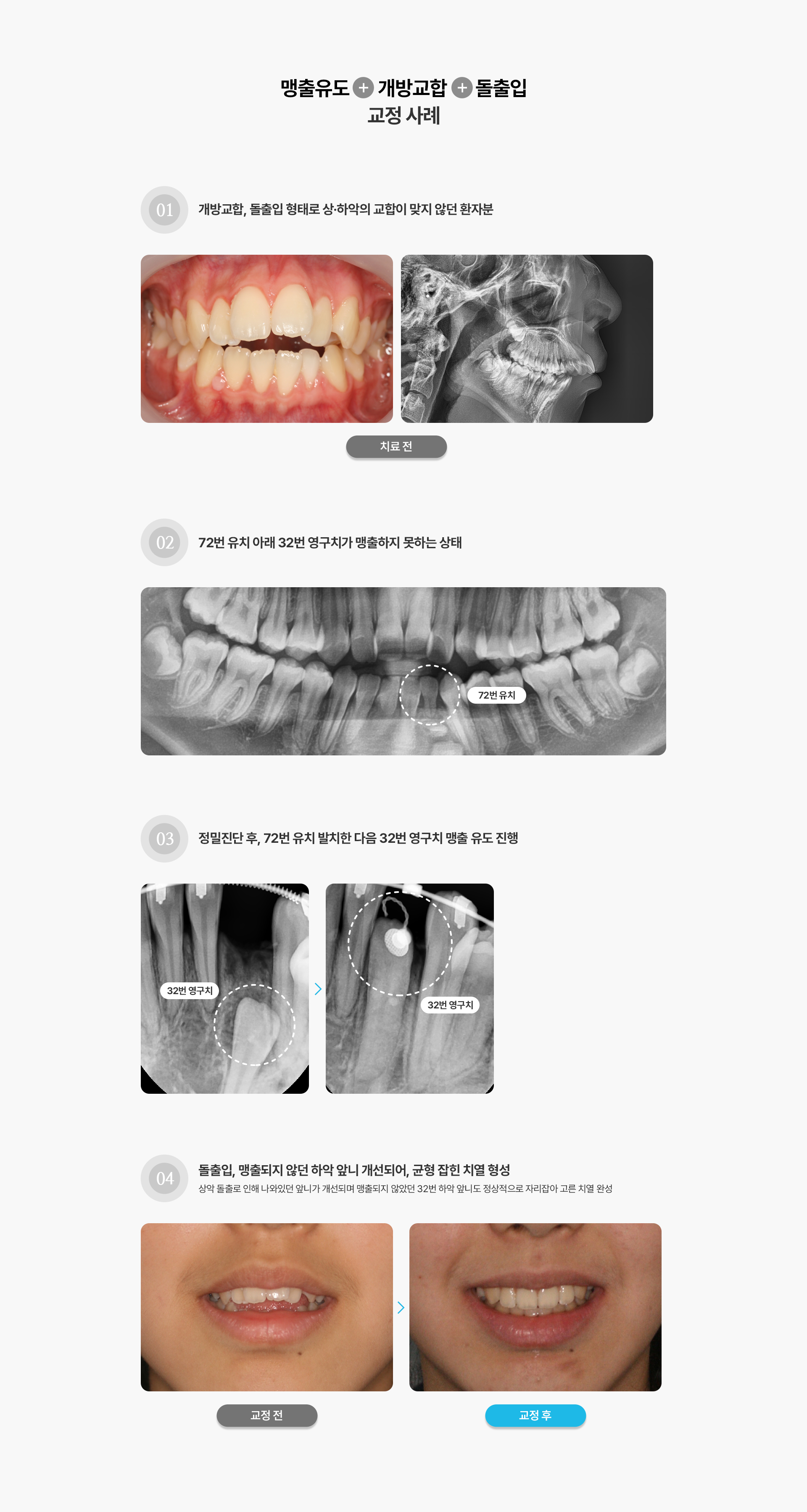 맹출유도교정