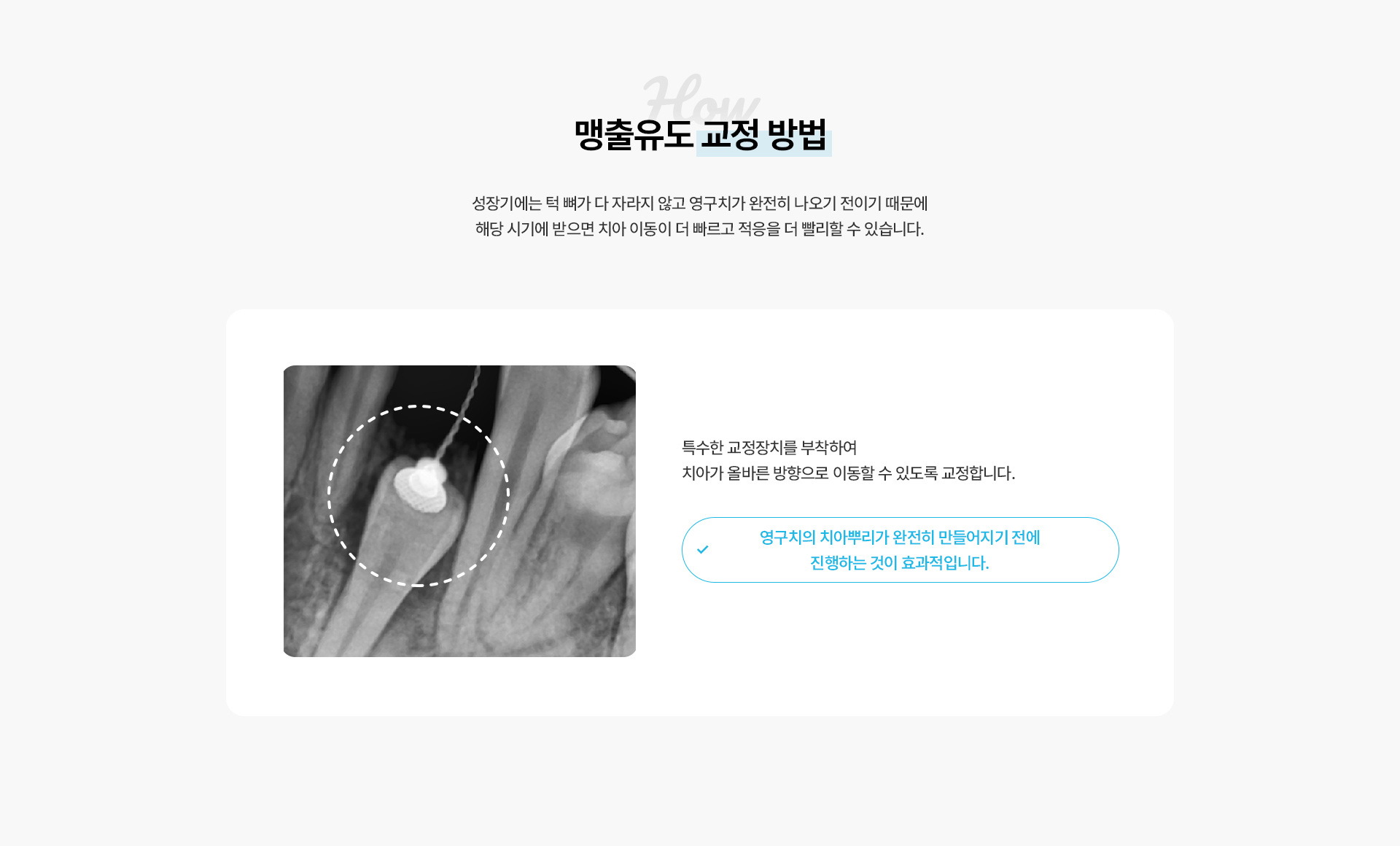 맹출유도교정