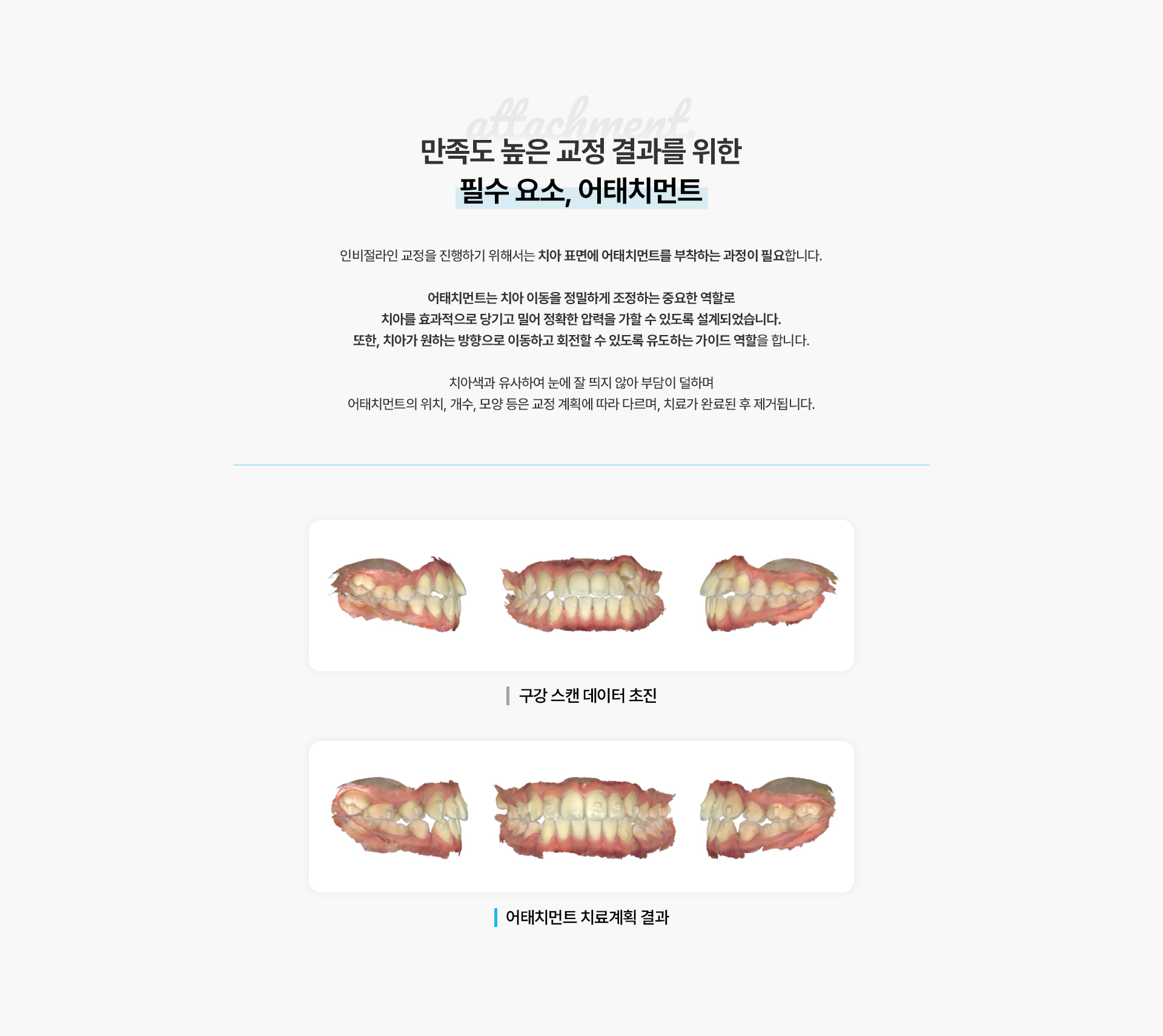 인비절라인센터