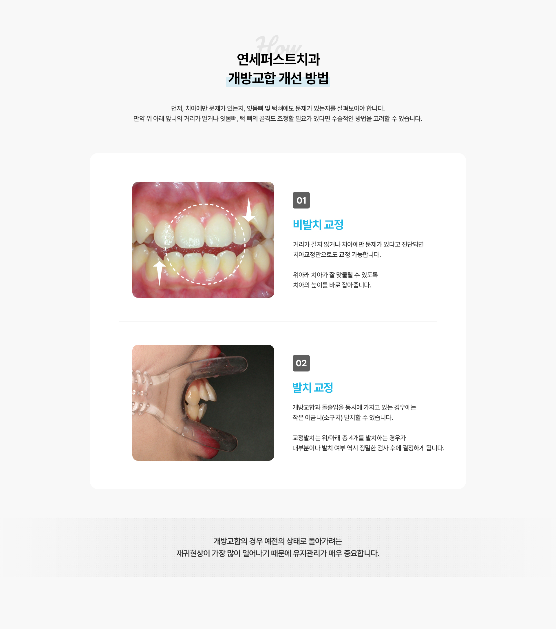 개방교합교정