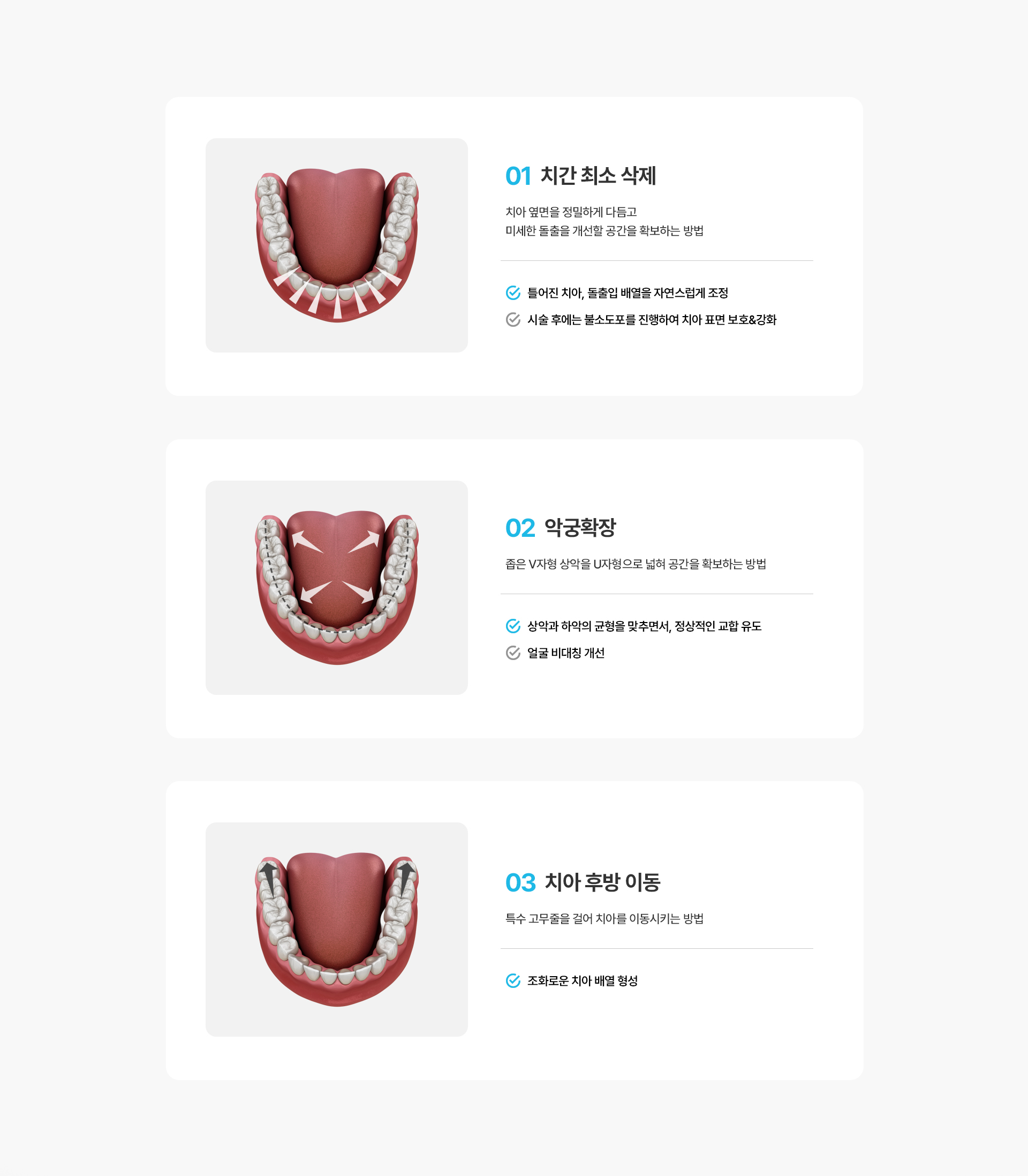돌출입교정