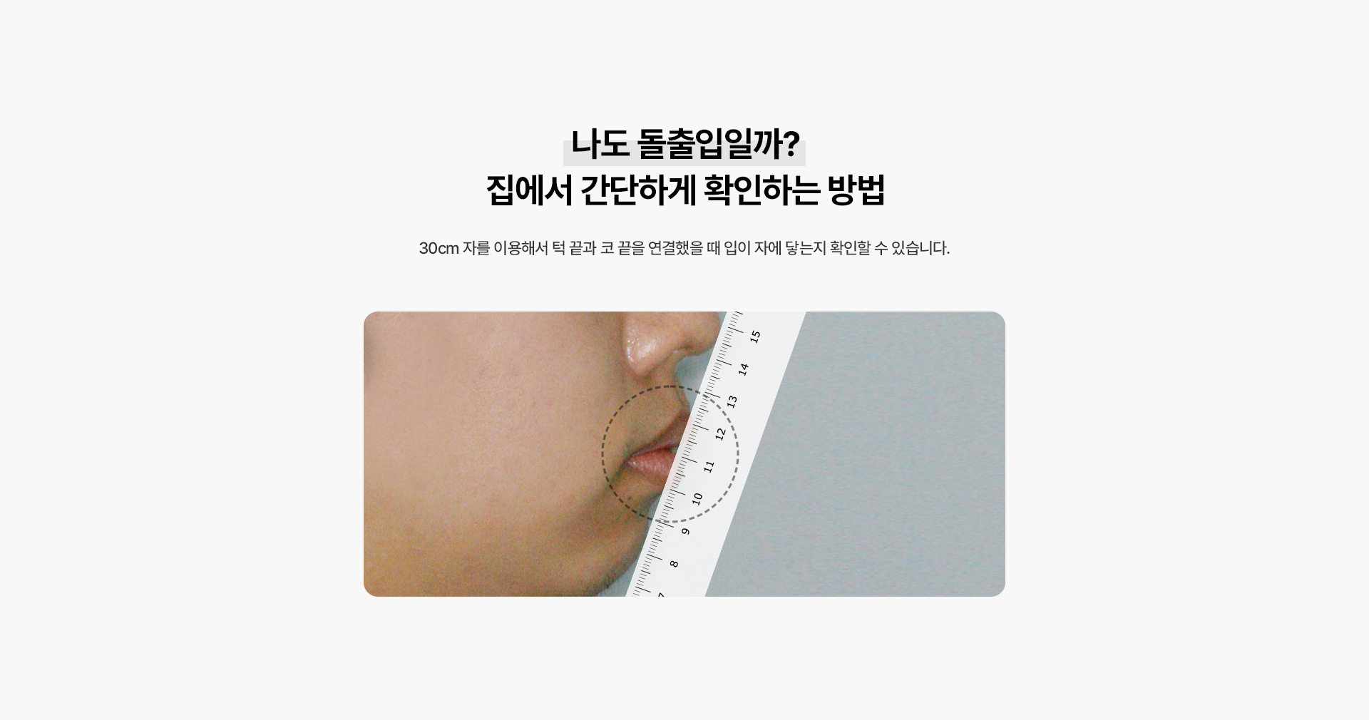돌출입교정