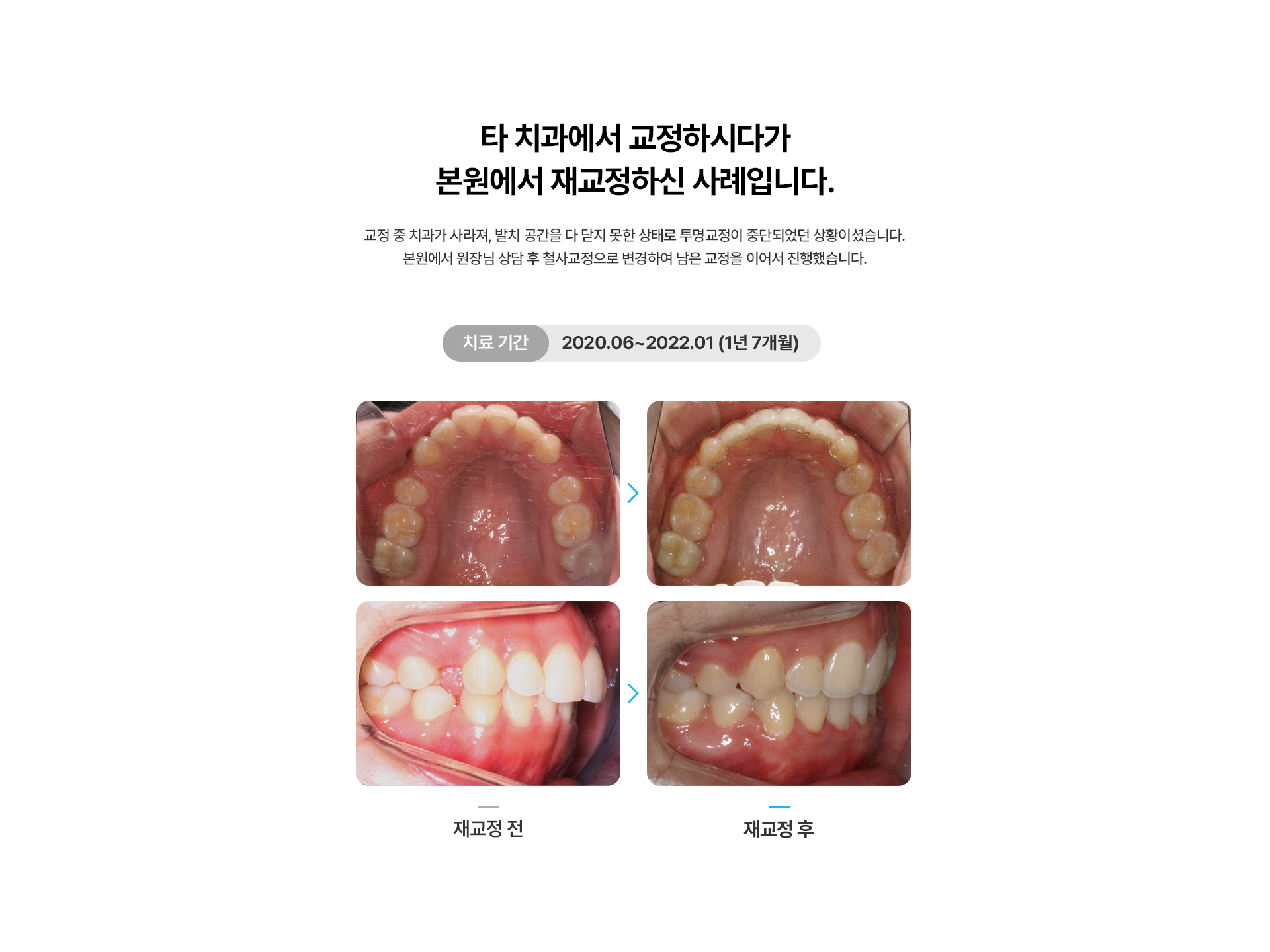 재교정