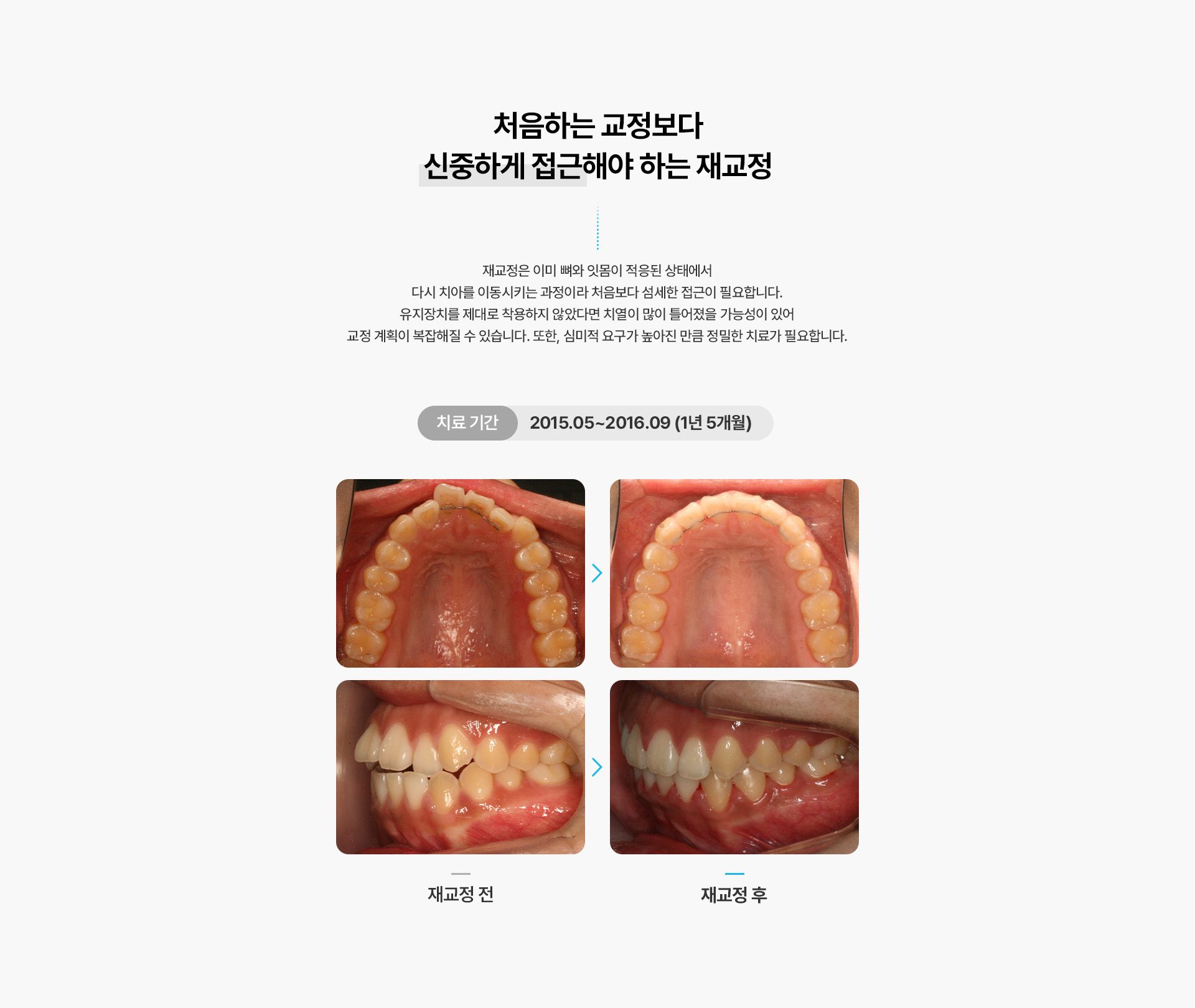 재교정