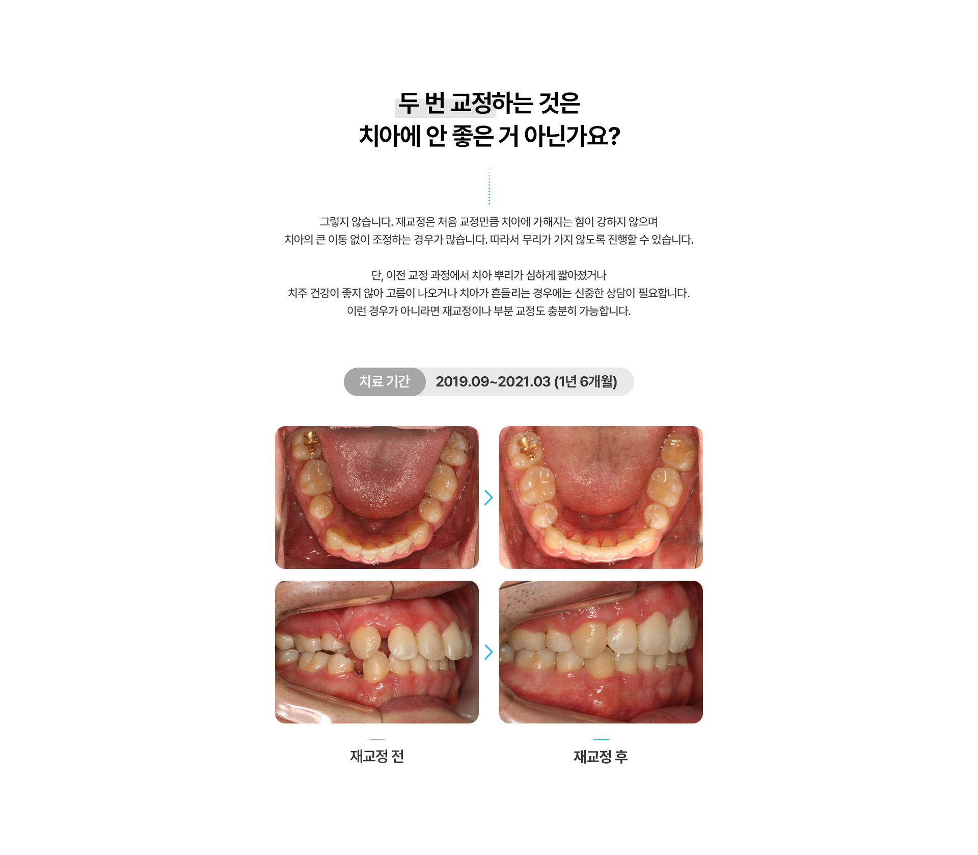 재교정