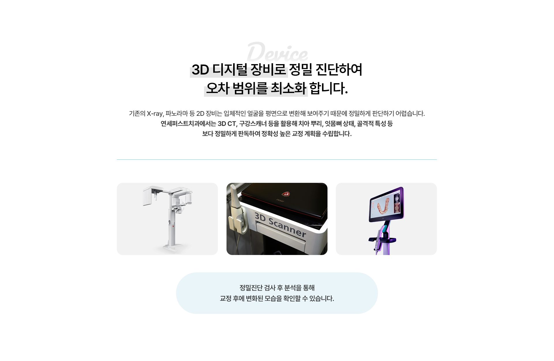 덧니교정