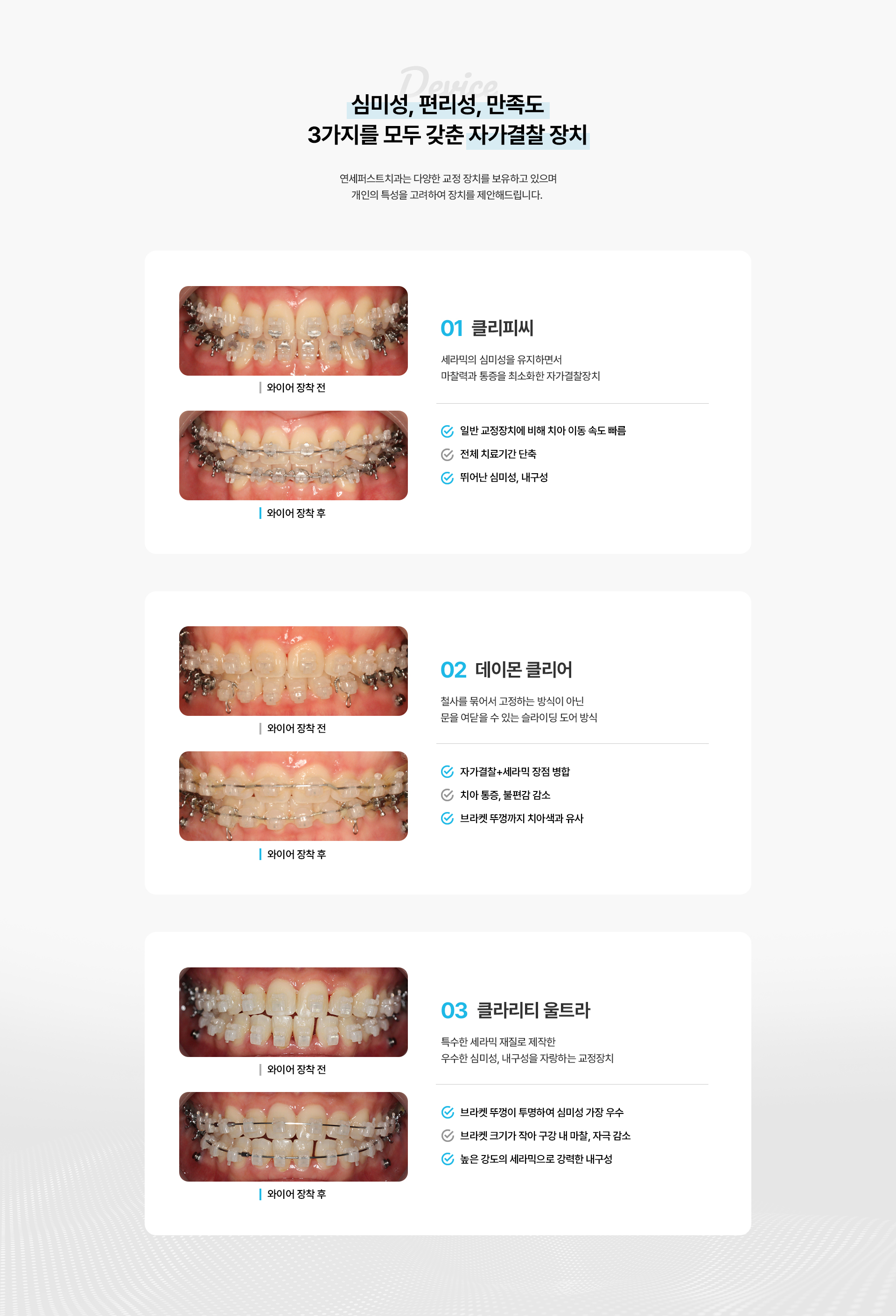 교정장치종류