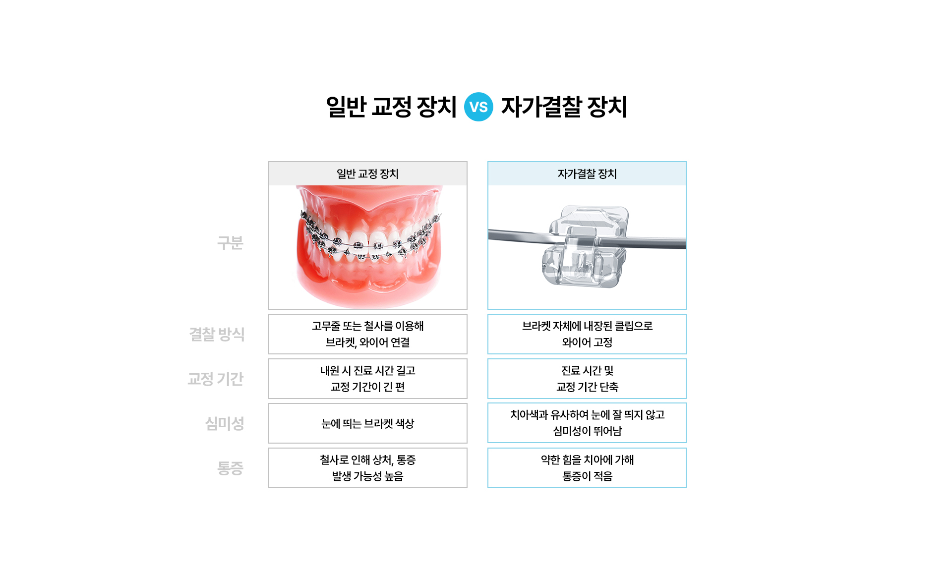 교정장치종류