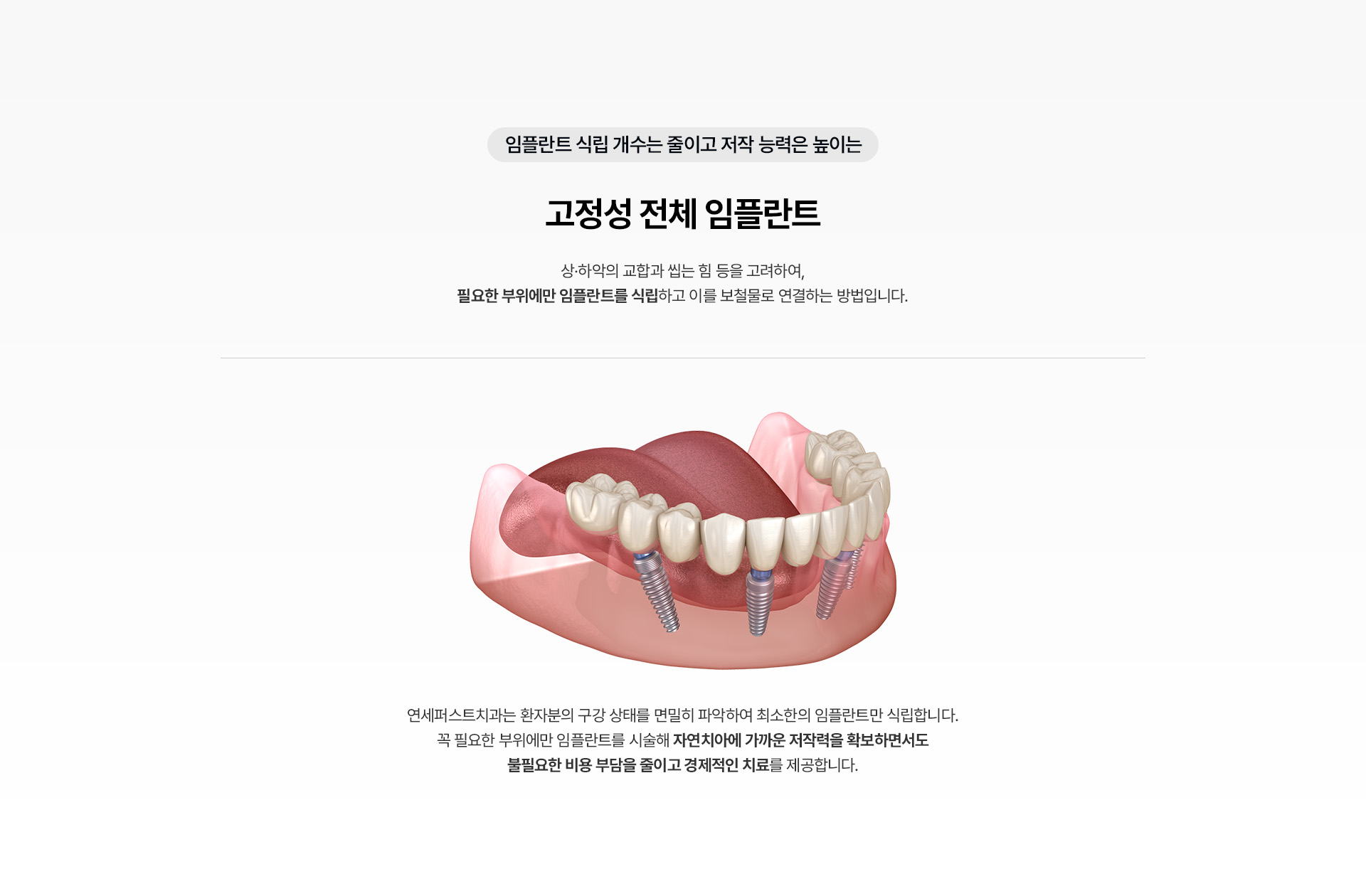전체임플란트