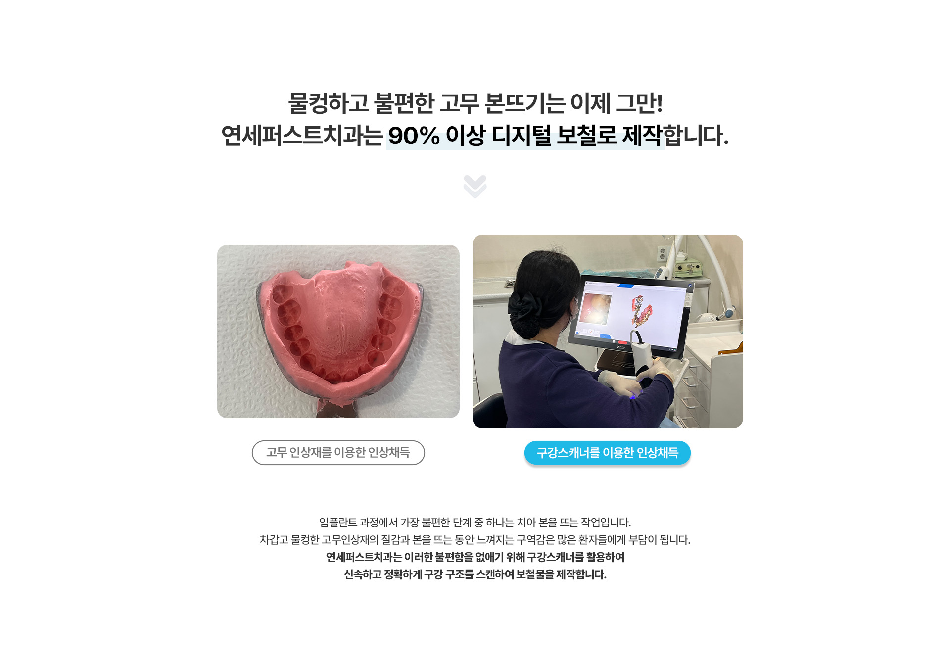 디지털 임플란트 보철
