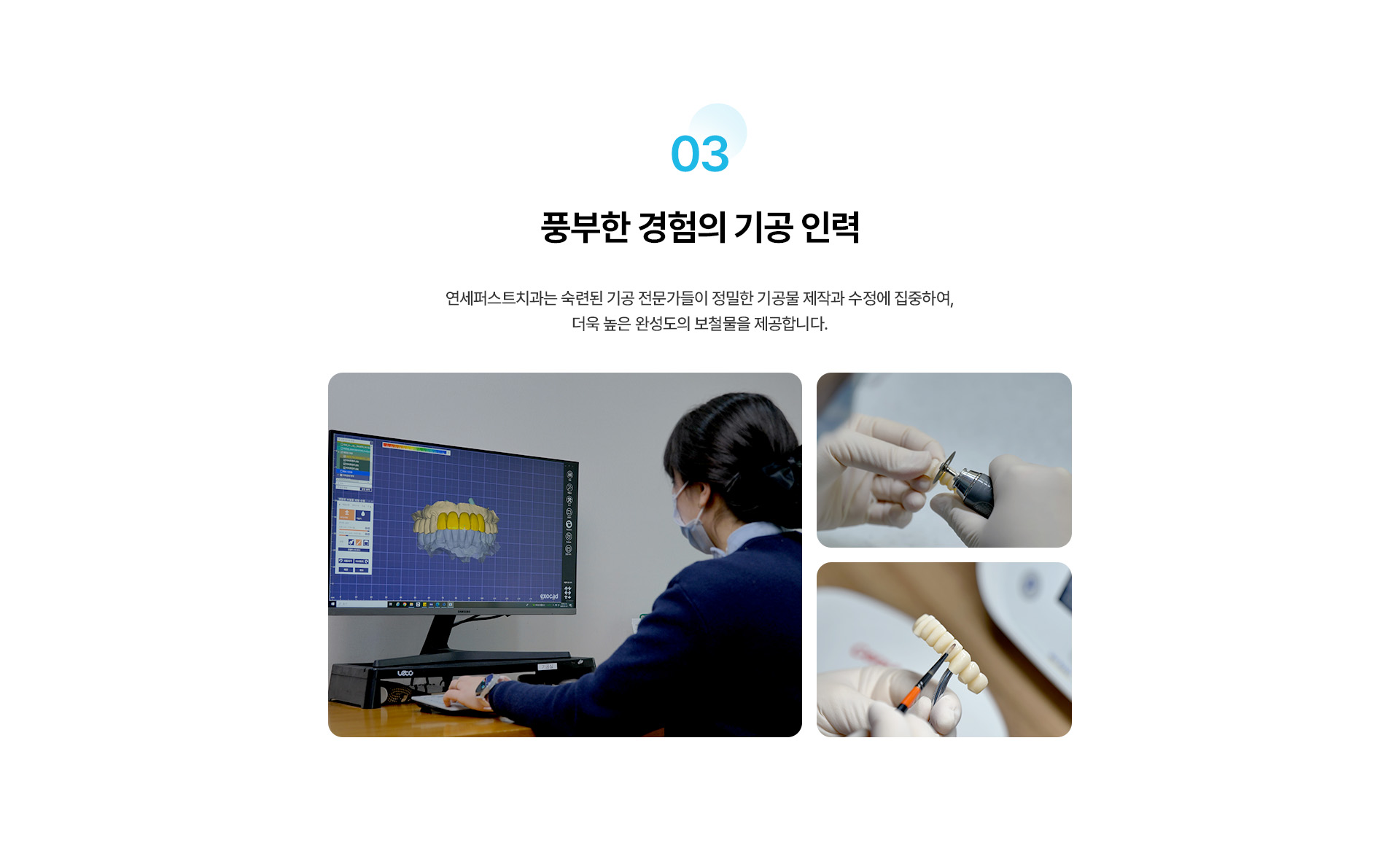 디지털 임플란트 보철
