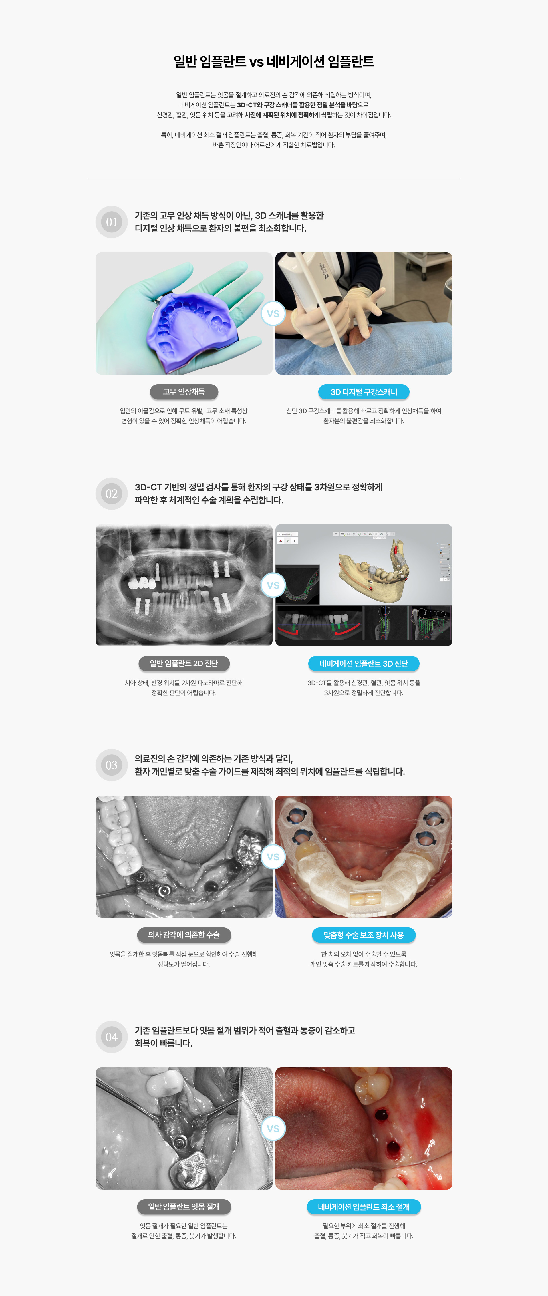 네비게이션최소절개임플란트