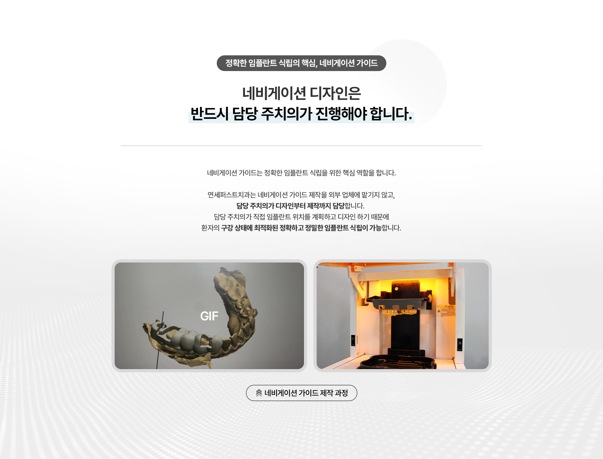 네비게이션최소절개임플란트
