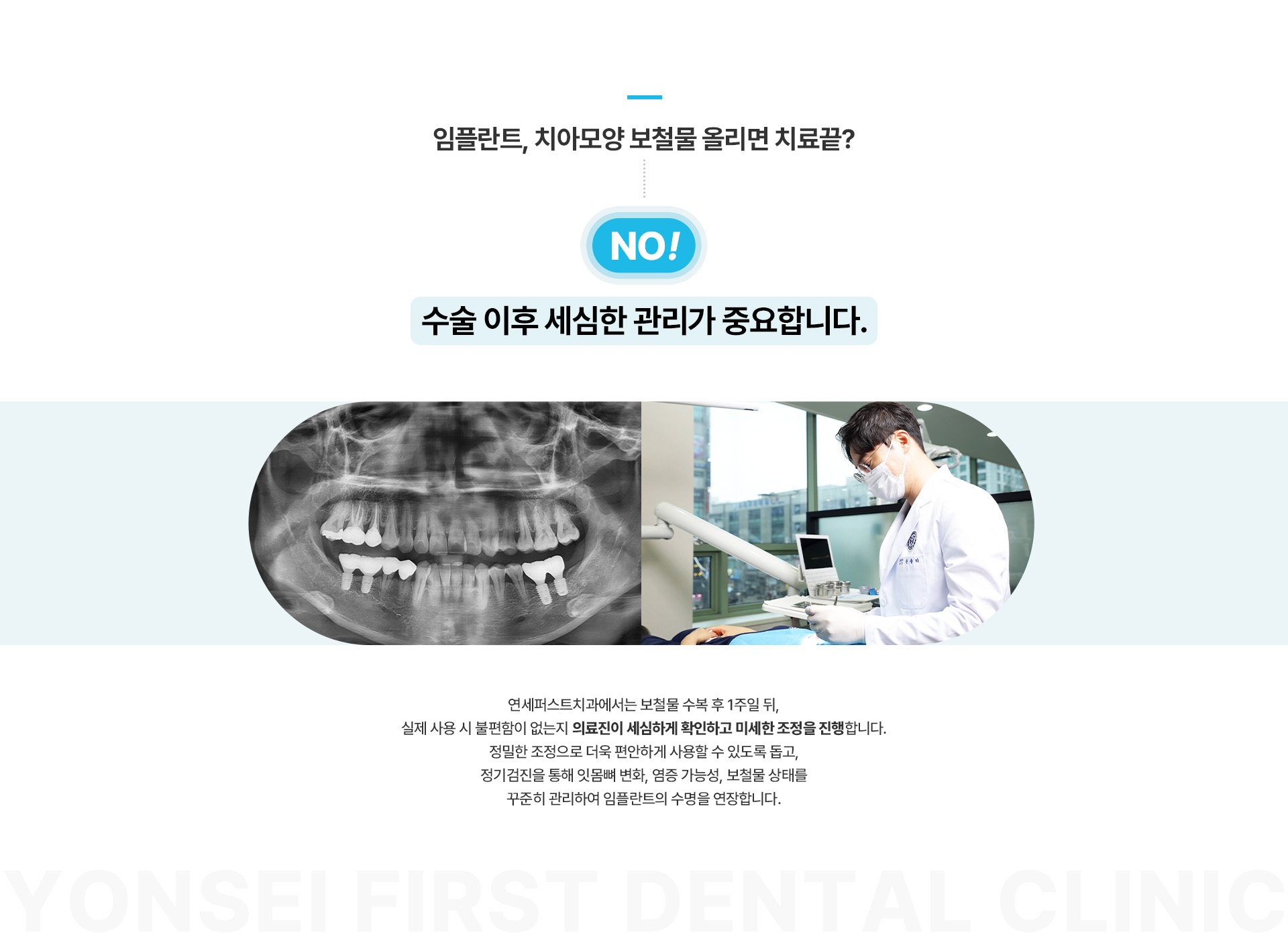 네비게이션최소절개임플란트