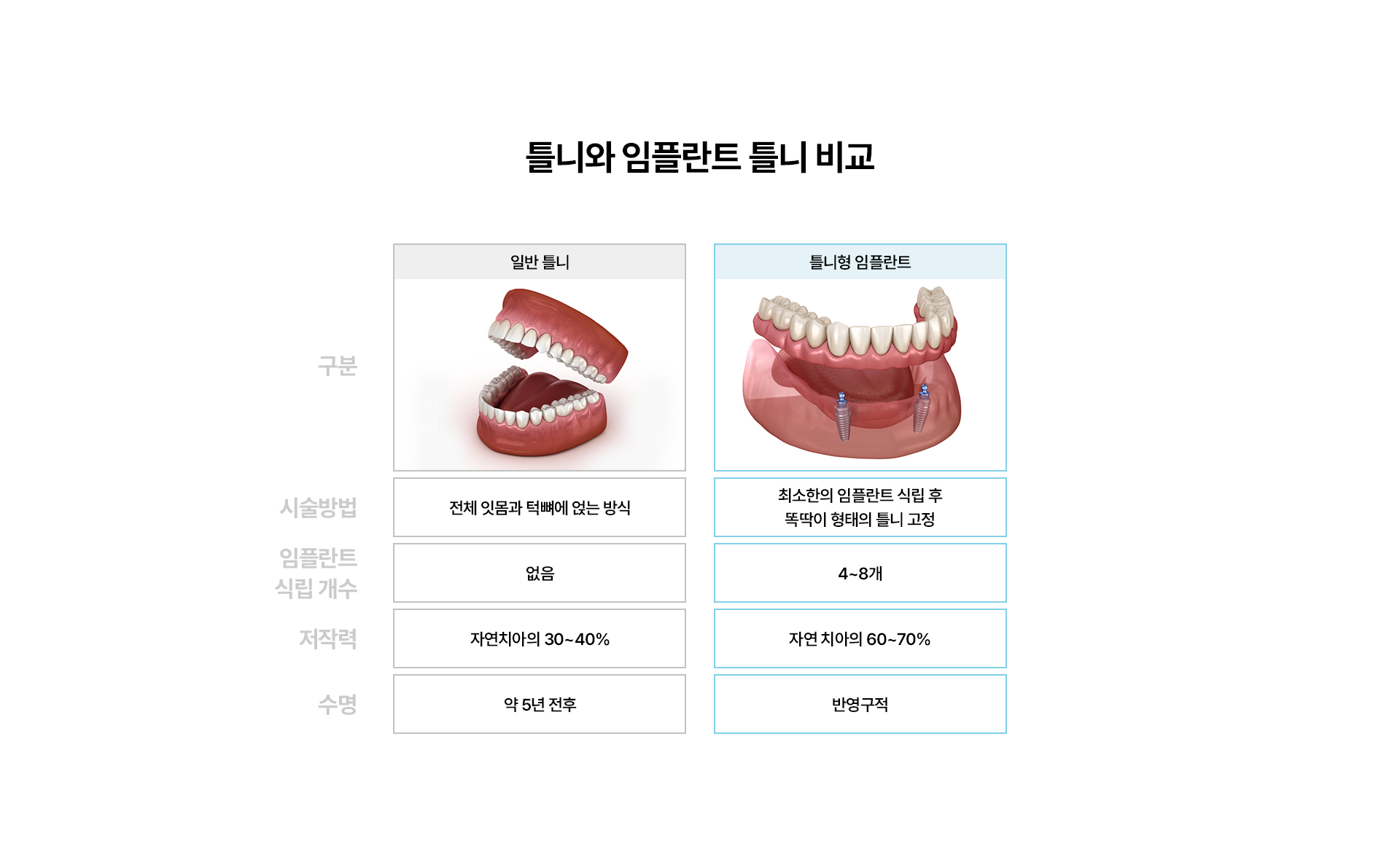임플란트 틀니(Locator)