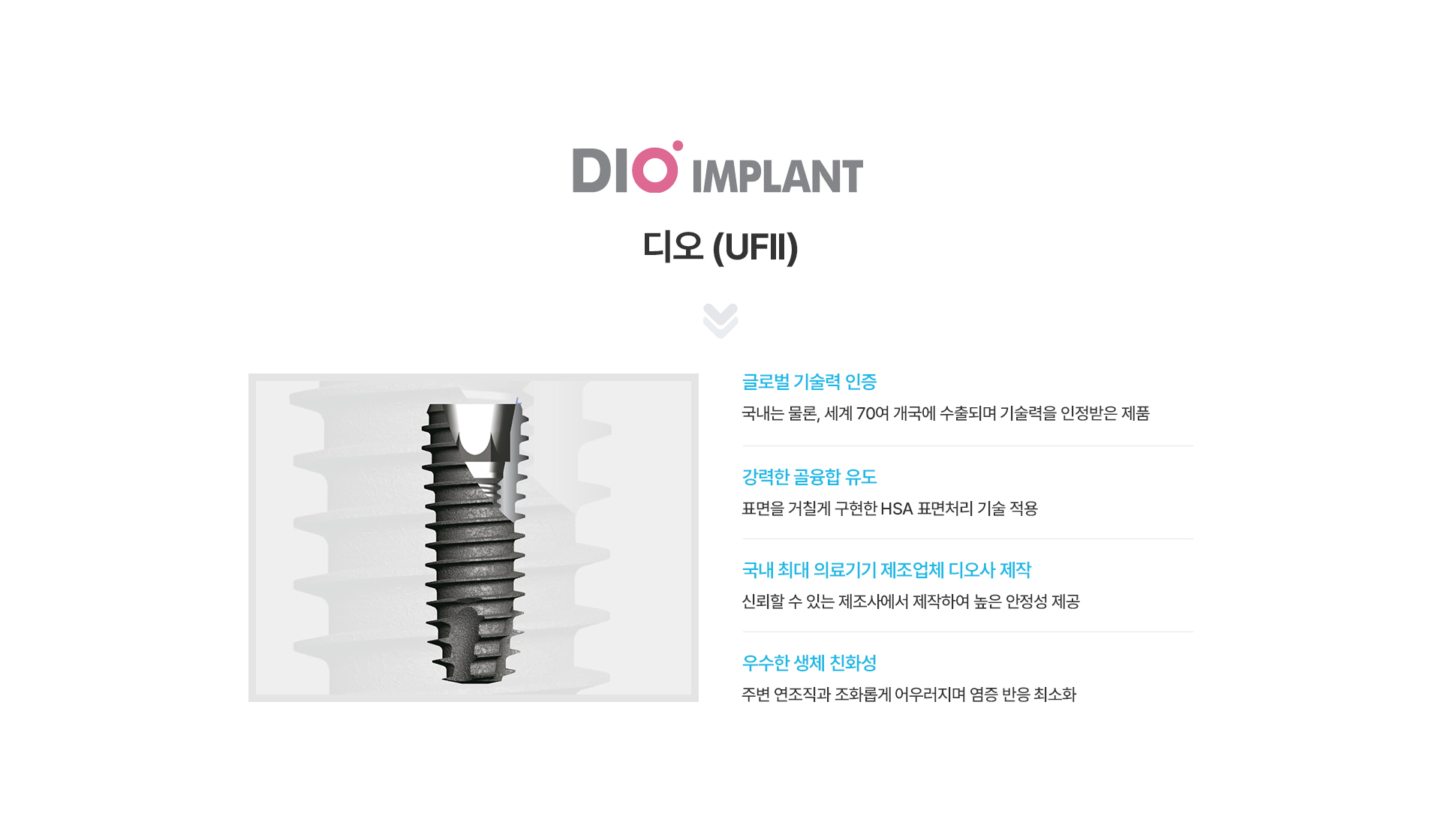 임플란트 종류