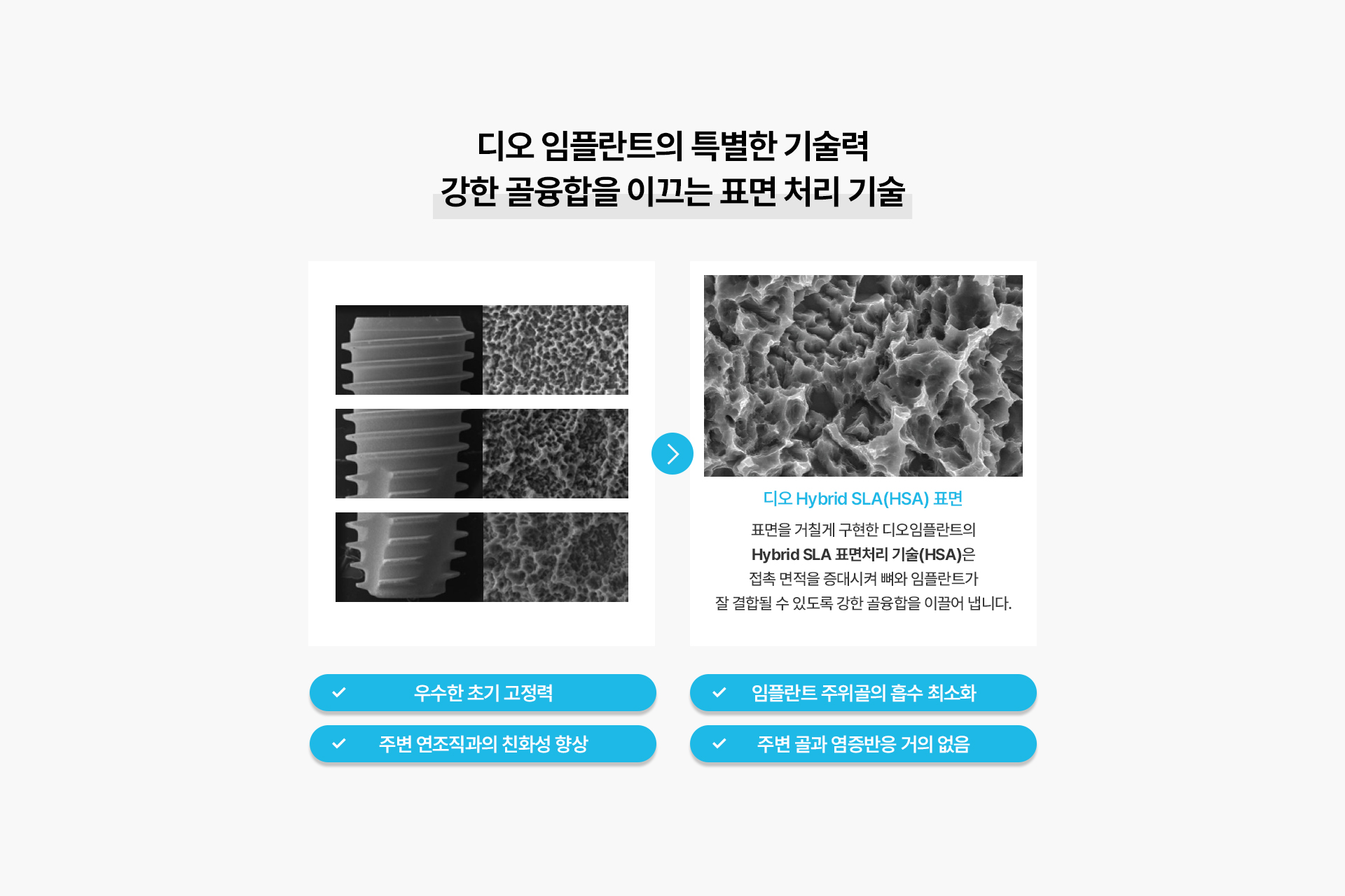 임플란트 종류