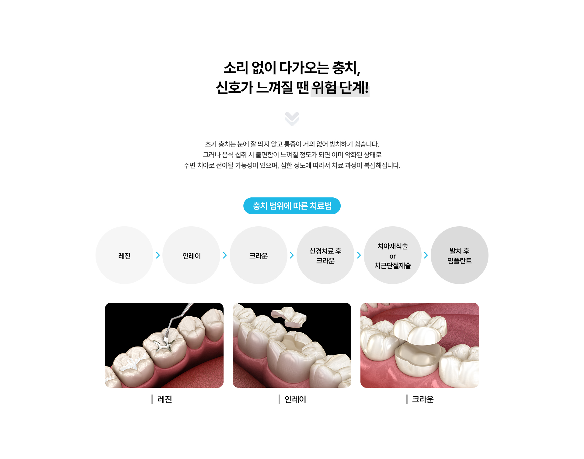 충치치료