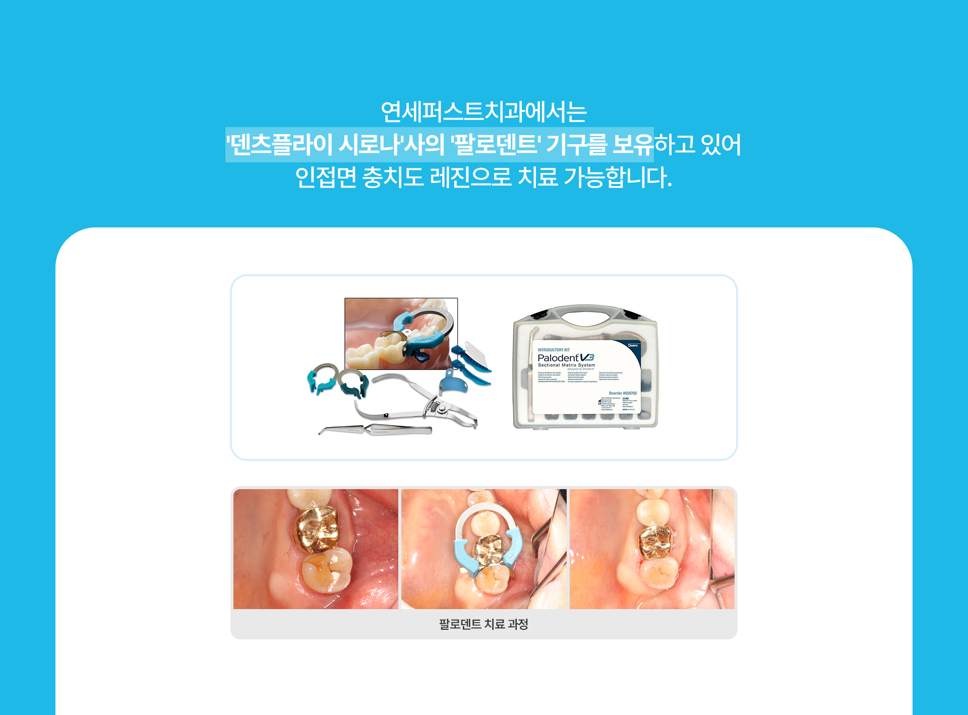 충치치료