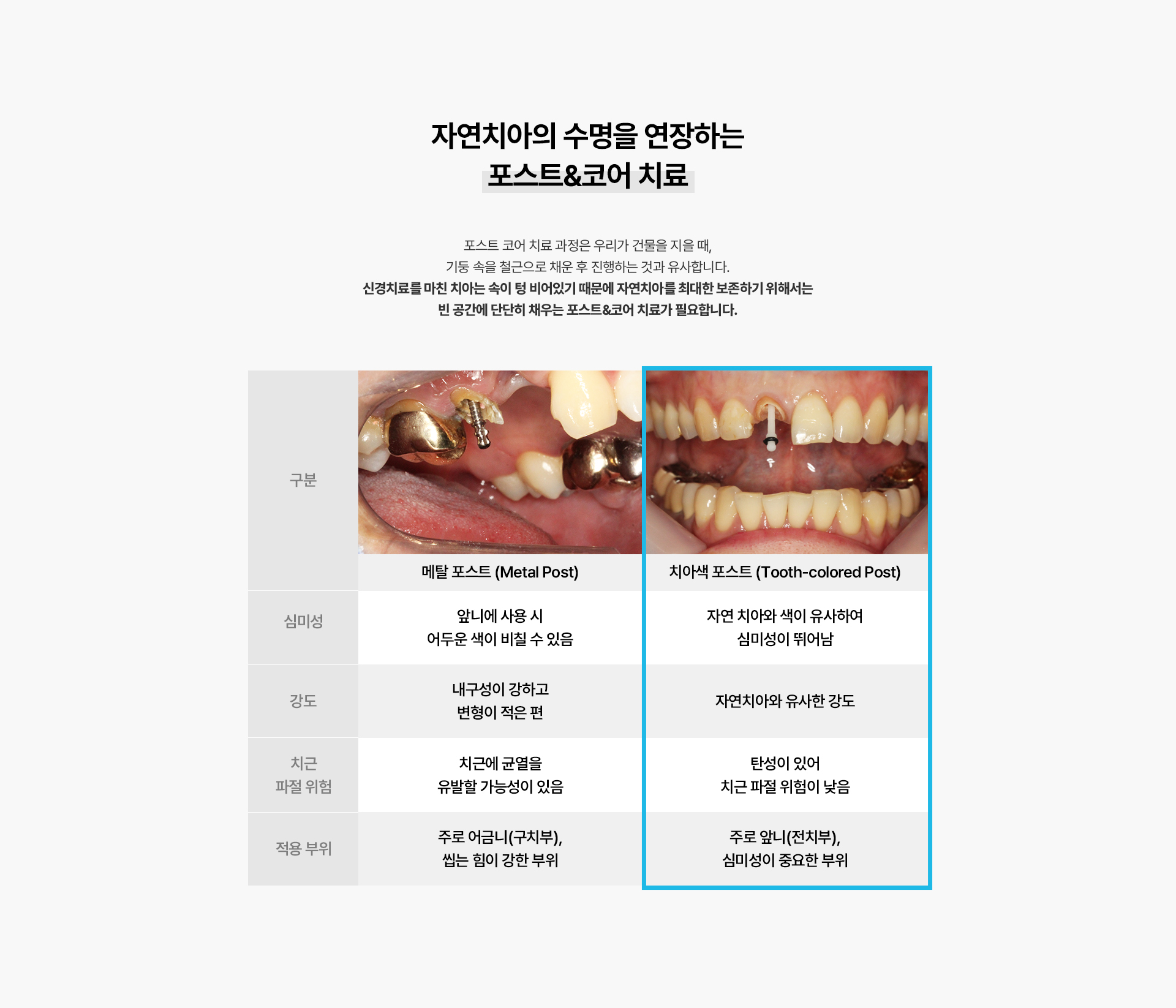 신경치료