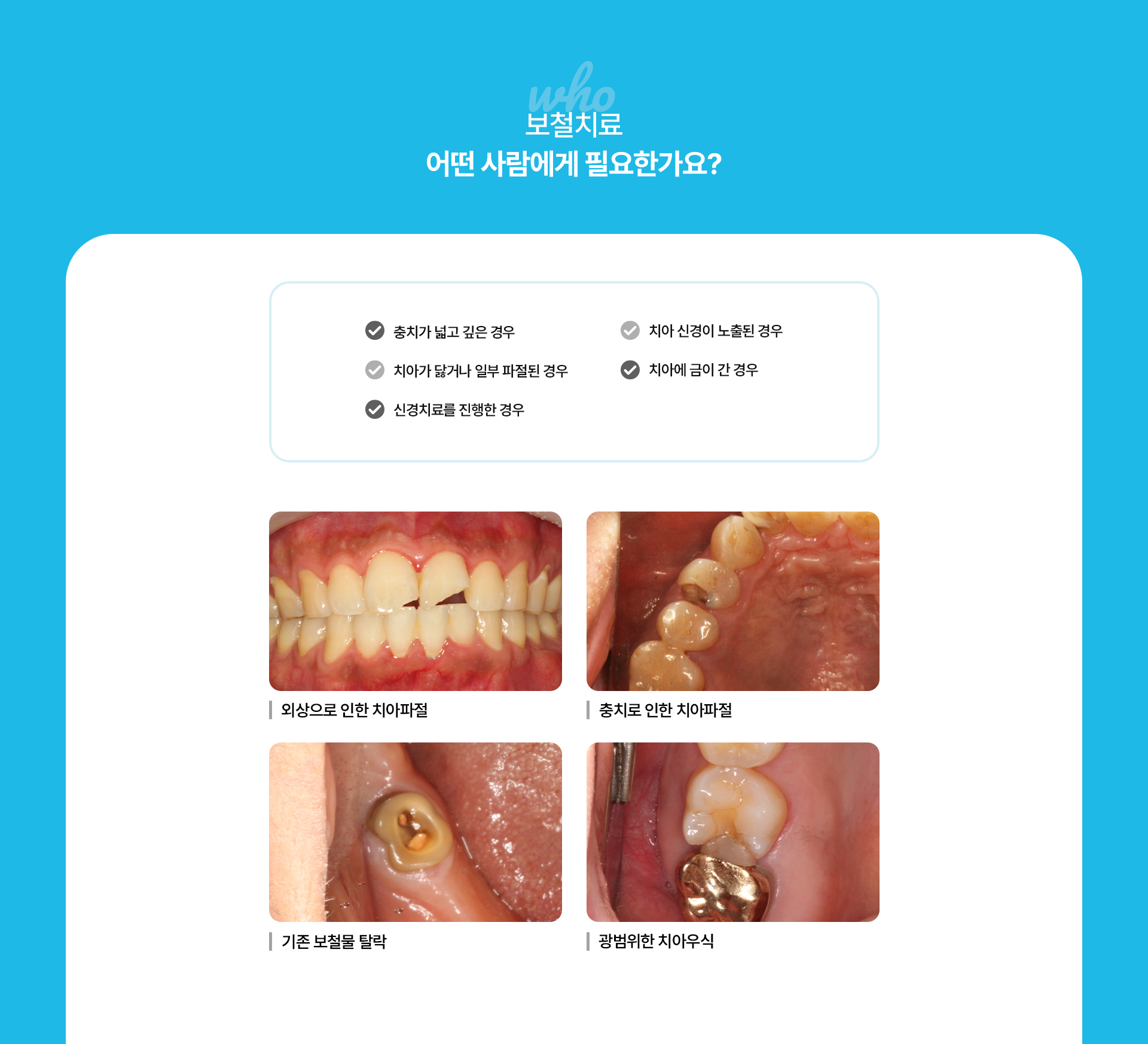 보철치료