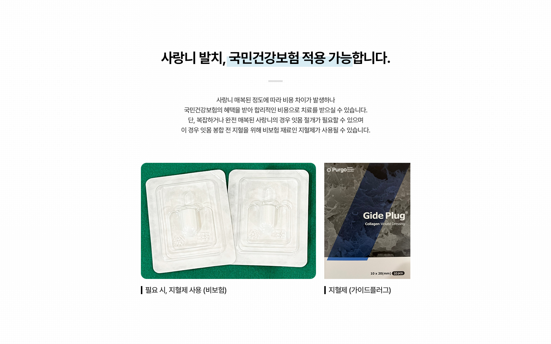 사랑니발치